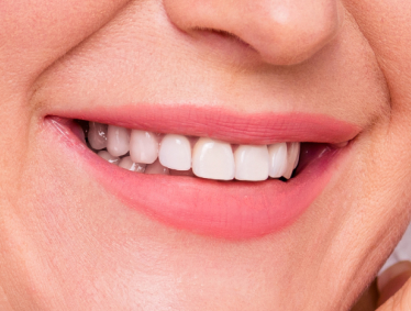 smile